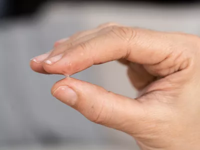 Quick and Easy Ways to Remove Epoxy from Your Skin